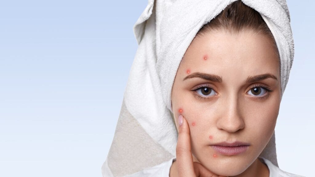 Remove Dark Spots On Face Tang