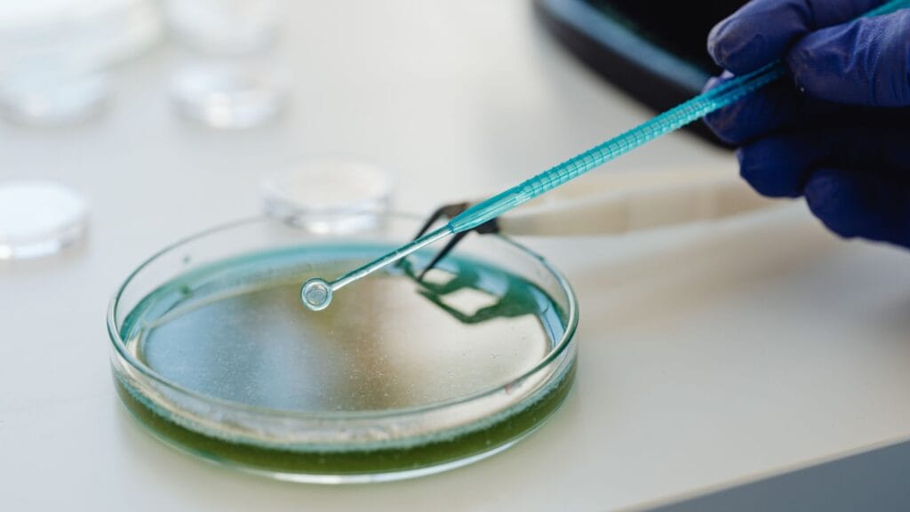 Pus Cells In Urine