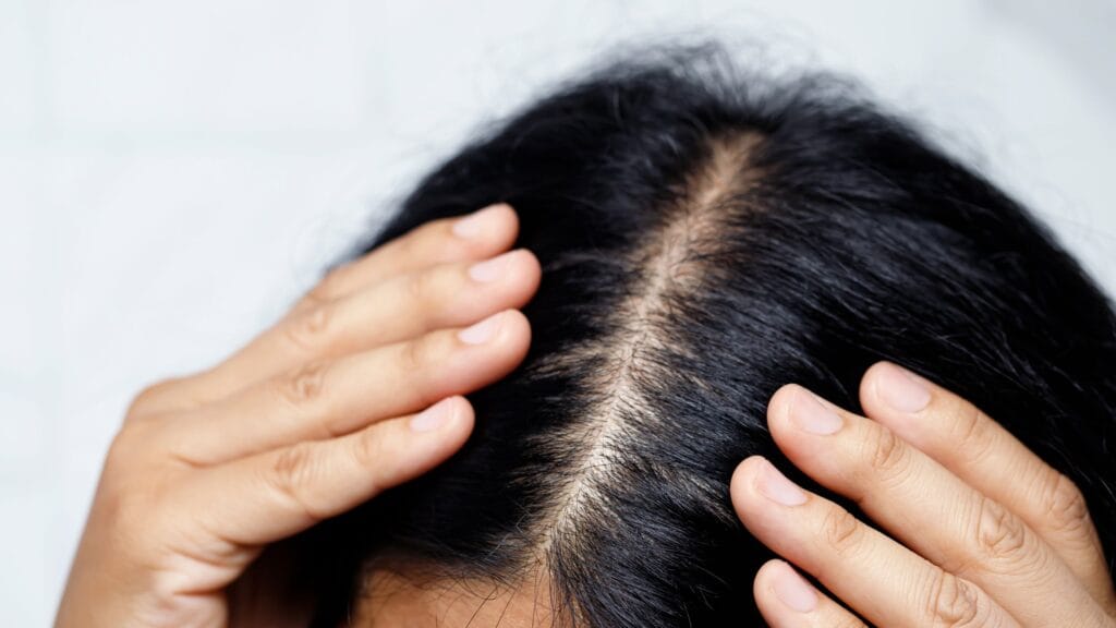 Curry Leaves Benefits For Hair